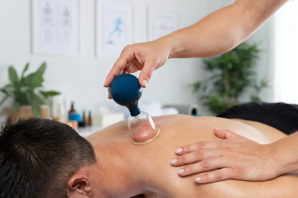 Cupping for Pain Relief in Darien & New Canaan