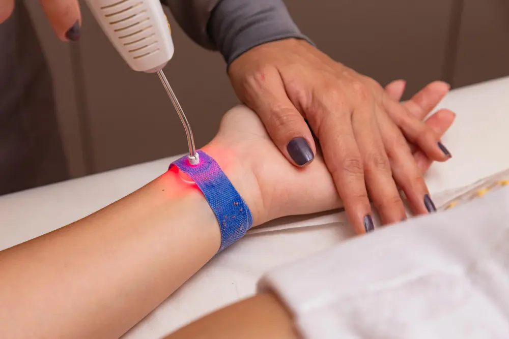 Carpal Tunnel Syndrome Laser Treatment