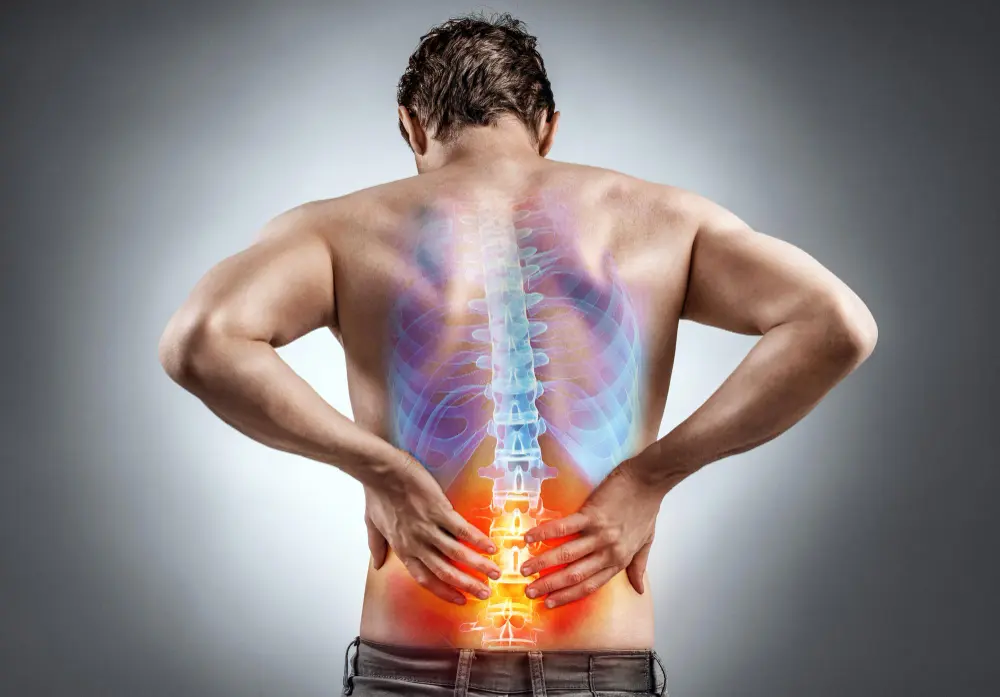 Lumbar Disc Sciatica