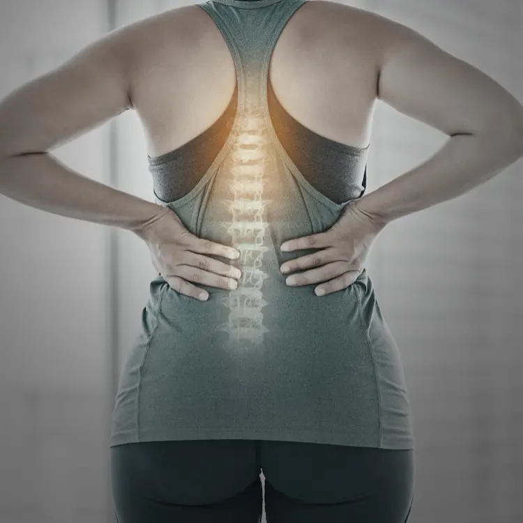 Spinal Stenosis Darienn